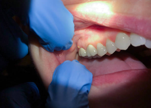 Best Emergency Gum Pain Relief  in Solvay, NY